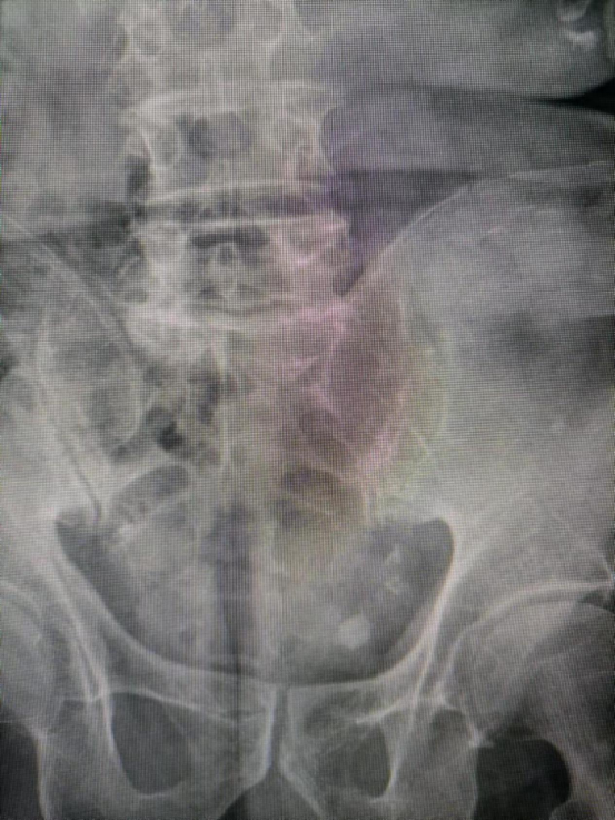 1638942567855815.png 0007.png