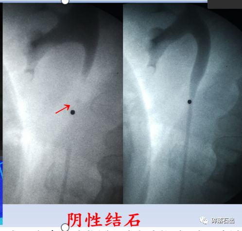 1642487816960487.png 0003.png